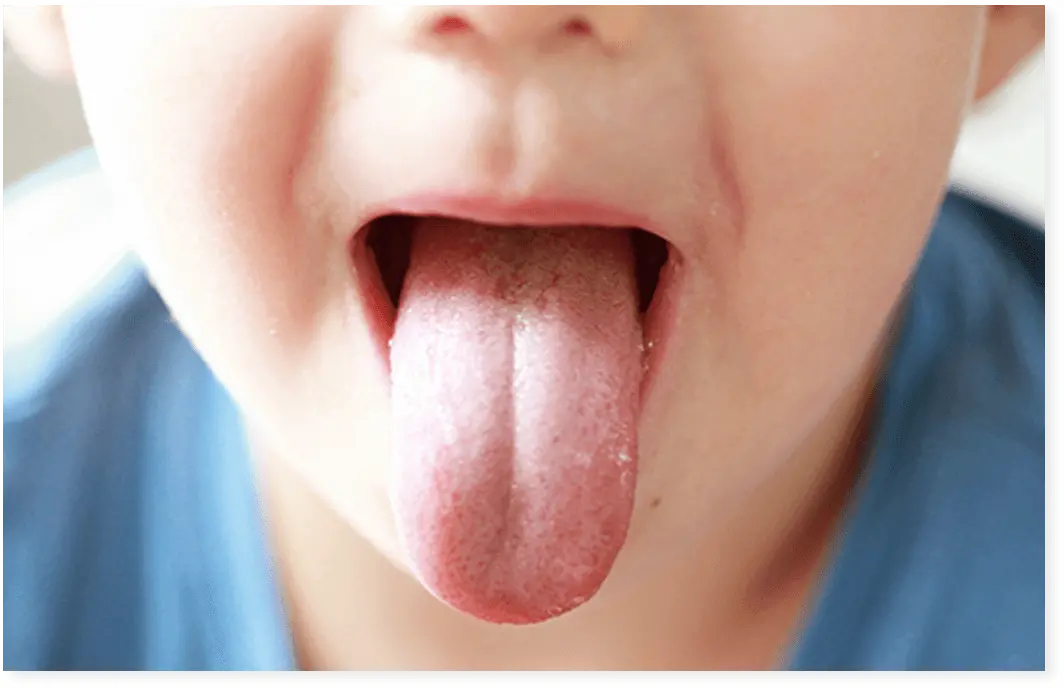 舌を前に伸ばす男の子の画像