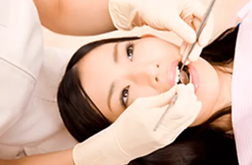 歯の検査を受けている女性の画像