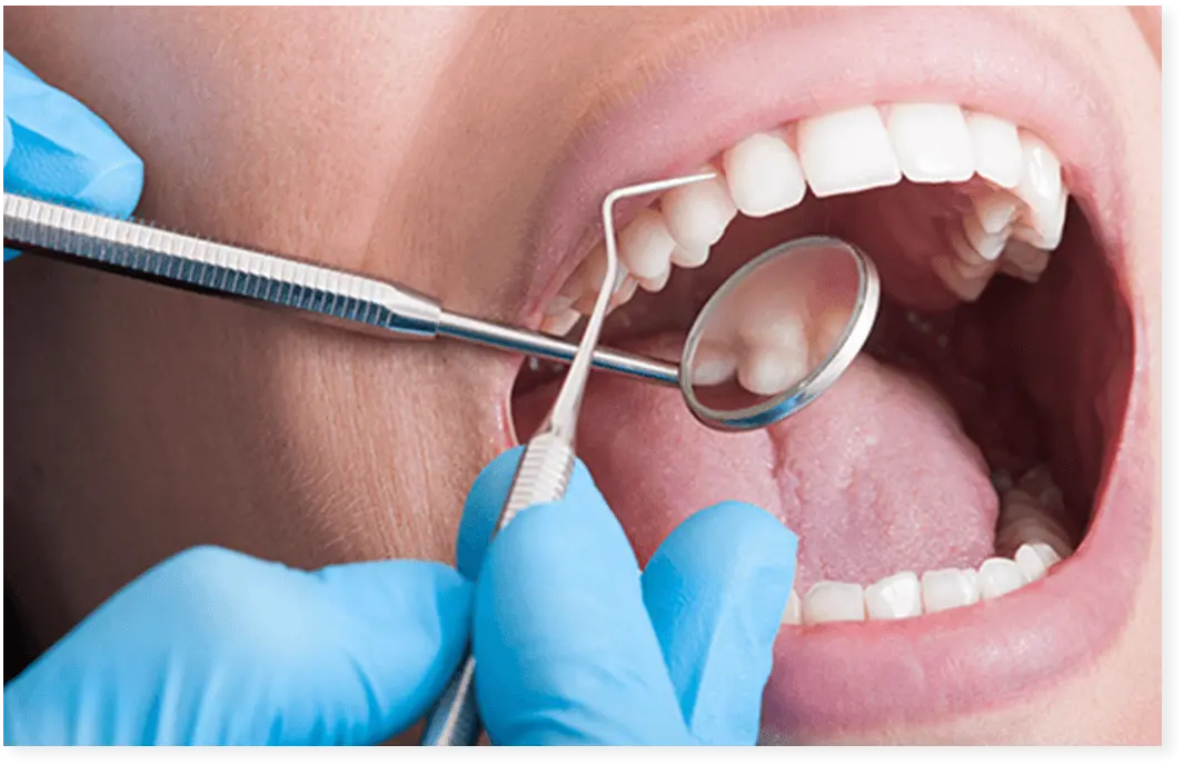 歯を治療している男性の画像
