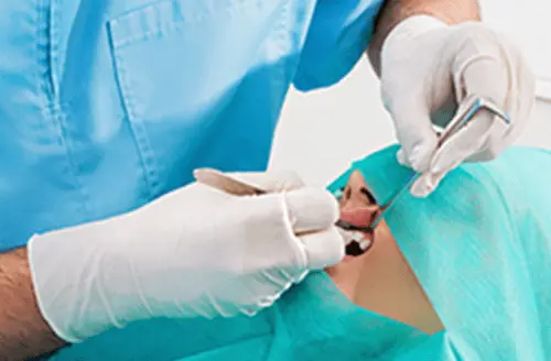 男性の歯科医師が歯を治療している画像
