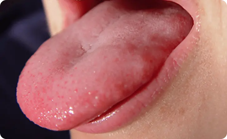 舌を前に出している画像