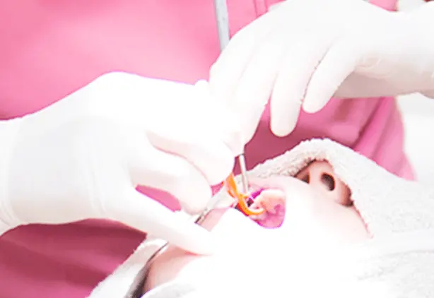 歯の治療をしている画像